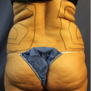 Back Pre