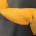 R arm pre