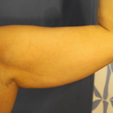 r arm back