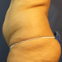 Side pre