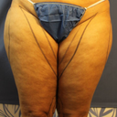 Thighs front pre
