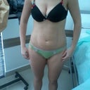 day of surgery