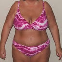 33 Days Post OP
