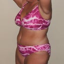 33 Days Post OP
