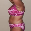 33 Days Post Op