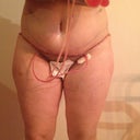 3 days post OP
