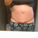9 weeks 1 day. Seems to be more swollen than the 4 week pic. What in the world?