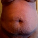 Front belly...lots of stretch marks, ugh!