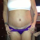 7 weeks, showing incision.