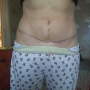 11 weeks po