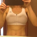 Swelling just below bra day 3 po