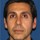 Revision Rhinoplasty