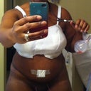 Day 6, still swollen of course...