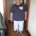 day before surgery 7/9/2009