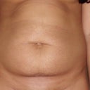 Before tummy