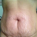 Before: Front 168lbs