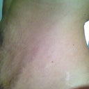 Before: Side 168lbs