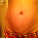 before picture
