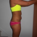Before - Side View