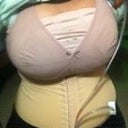 1 week post op