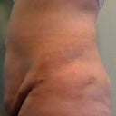 Day 11, right side full turn