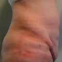 Day 11, left side full term