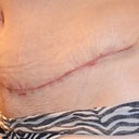 April 22, right view