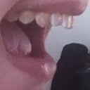 I don't know why the lighting made some of my teeth look yellow in these photos, ugh.. they're not yellow in real life LOL