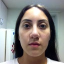 After-7 weeks, look at the left side of the pic how my nose appears as if its curving