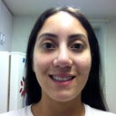 After-7 weeks, notice on left side of pic as I'm smiling how my nose appears as if its curving