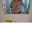 Sneeked off to toilet to take photos before surgery!!!!