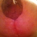 4 weeks post op