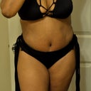 19 days post opt! I can see where my figure is starting to come out. Less swelling and fluid!