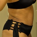 19 days post opt! Need to hit the gym to tone back up but even if I could never work out again and still look like this I would be happy!