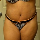 19 days post opt! I always hated this outfit but it looks great now!