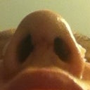 Nostrils still uneven but a tad bit better than yesterday!