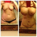 Before and 7 days post op