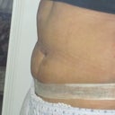 5 weeks post tt