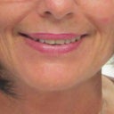 My mother always told me to smile but now I have wrinkles under my eyes.  Catch 22 as look what happens when I don't smile in the next picture.  I have a wonderful cat who makes me smile but he's sick so more often I must look like the next picture: