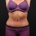 After! Feb 2012