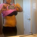 Almost 4 months from surgery date - 03/16/12. This is my lower scar side.