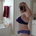 swelling of lower belly is still obvious