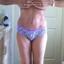 5 weeks post op 2