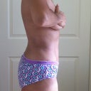 5 weeks post op side