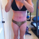 5 weeks 4 days. New bikini!  Check out the marks from my compression. Yikes!