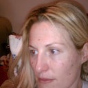 day 3, spots even darker...some look grainy..none have fallen off