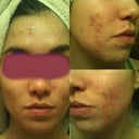 Day 1. Eww..