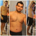14 days post op