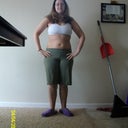 post op 5 days 4/4/10