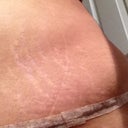 SWOLLEN OUCH OUCH OUCH
